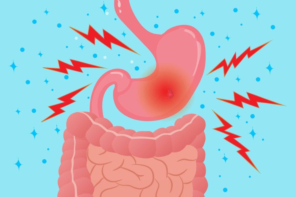 Stomach Ache & Acupuncture for Pain Relief in Tokyo 3 Stomach Ache & Acupuncture for Pain Relief in Tokyo