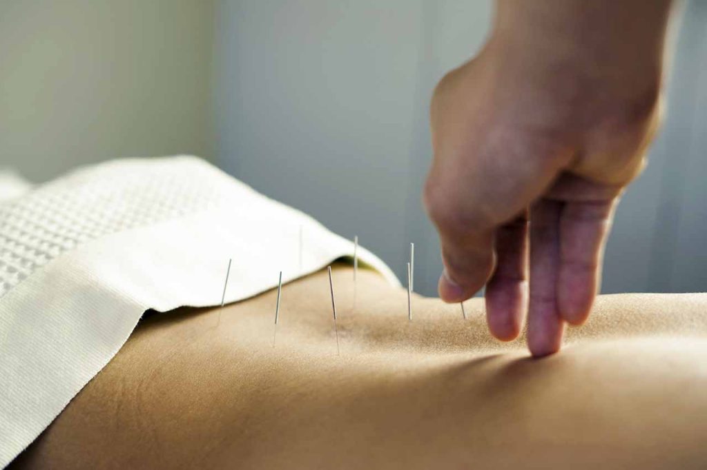 Find Natural Relief for Lower Back Pain with Acupuncture 6 Find Natural Relief for Lower Back Pain with Acupuncture