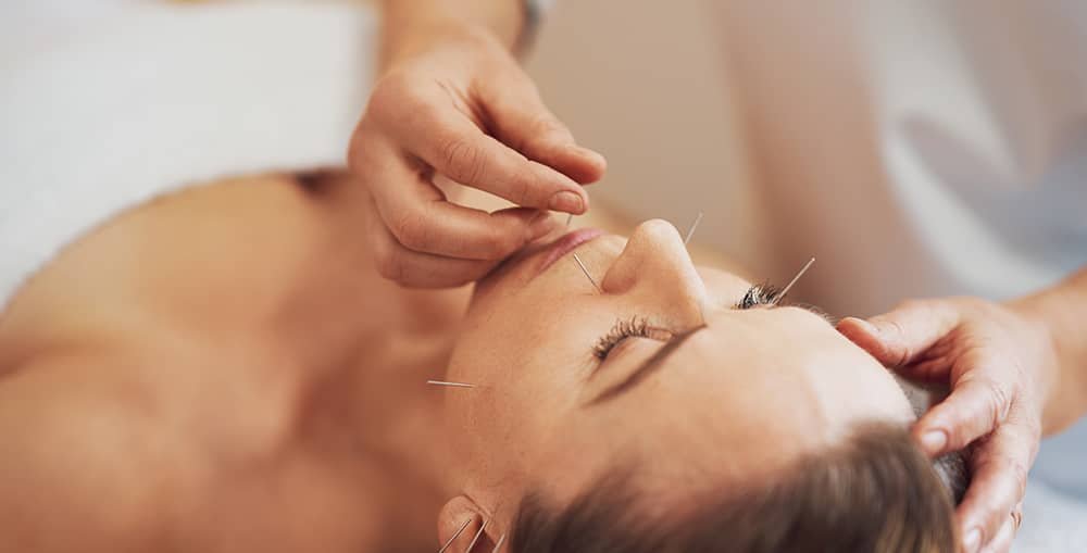 Can Acupuncture Help with Stress? 3 Can Acupuncture Help with Stress?
