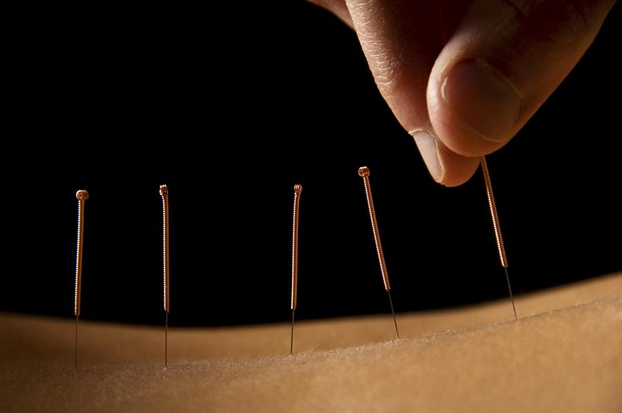 Acupuncture Benefits and Risks 2 Acupuncture Benefits and Risks