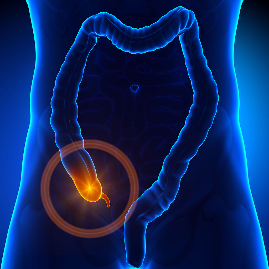 Appendicitis & Acupuncture Treatment in Tokyo 4 Appendicitis & Acupuncture Treatment in Tokyo