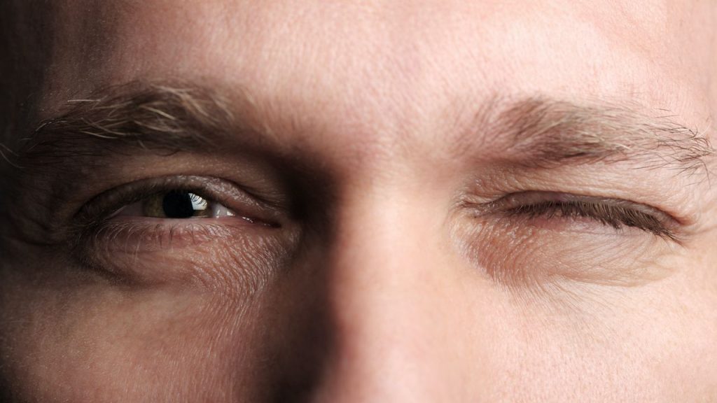 Acupuncture for Blepharospasm in Tokyo 2 Acupuncture for Blepharospasm in Tokyo