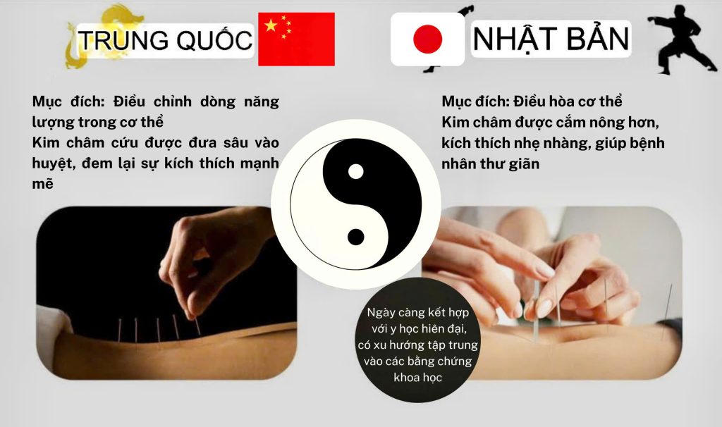 Sự khác biệt của Châm cứu Nhật Bản và Châm cứu Trung Quốc
