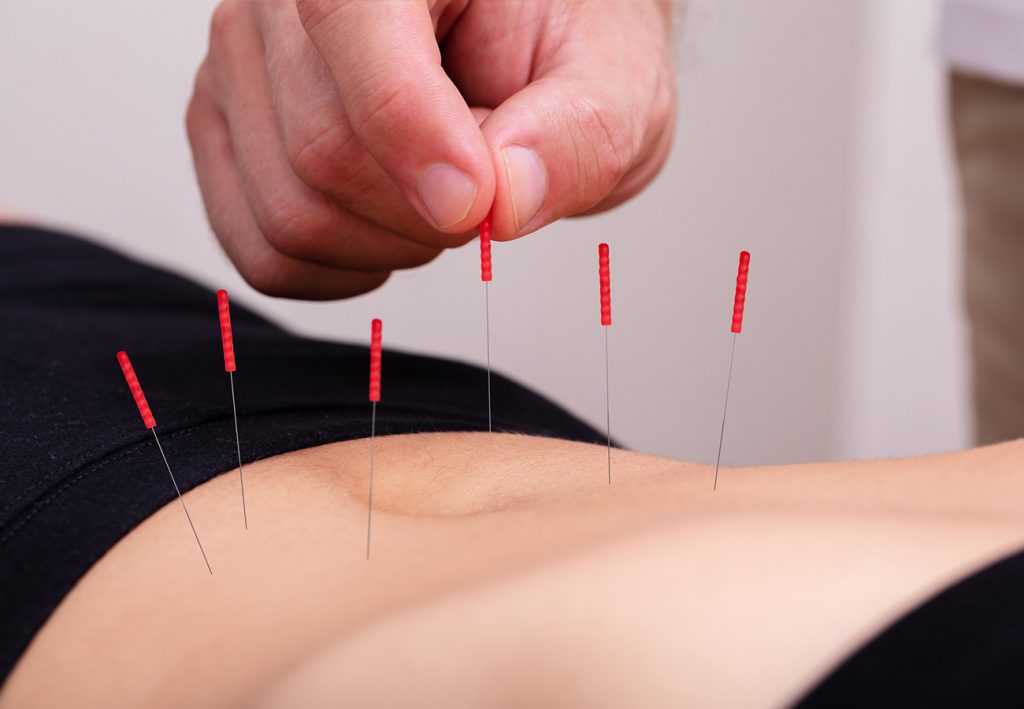 Acupuncture for IVF Implantation in Tokyo 4 Acupuncture for IVF Implantation in Tokyo