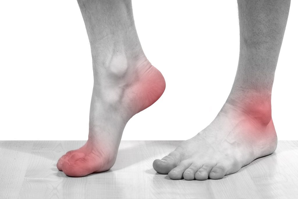 Foot pain and Acupuncture for foot pain in Tokyo 2 Foot pain and Acupuncture for foot pain in Tokyo