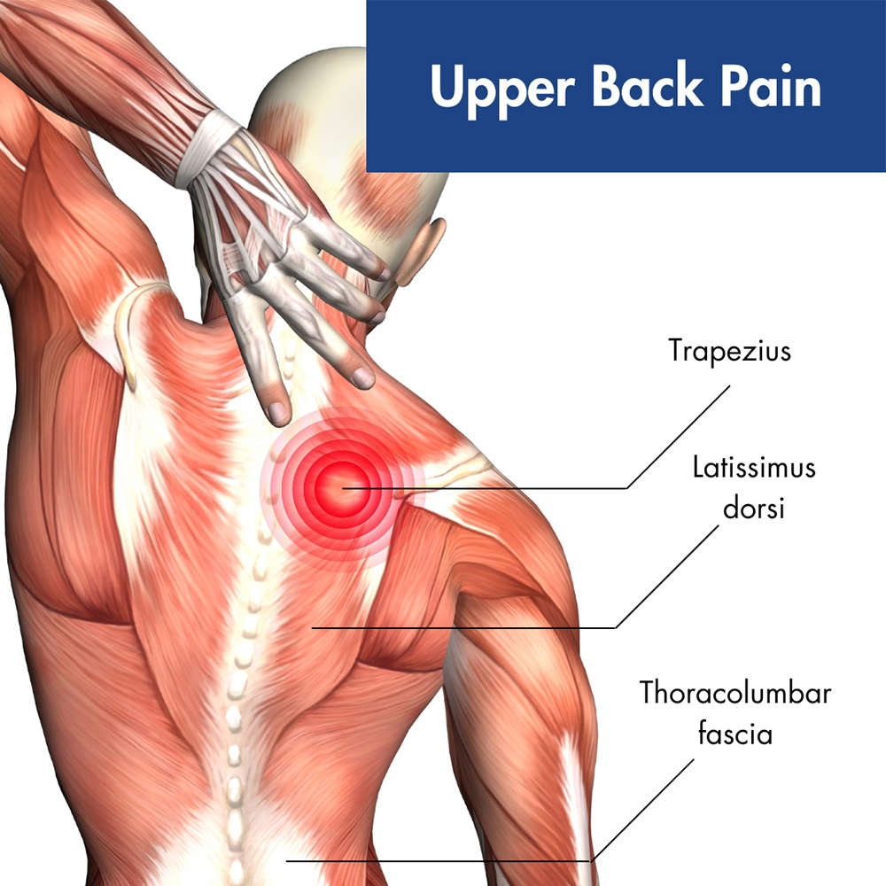 Upper back pain & Acupuncture Treatment in Tokyo 5 Upper back pain & Acupuncture Treatment in Tokyo