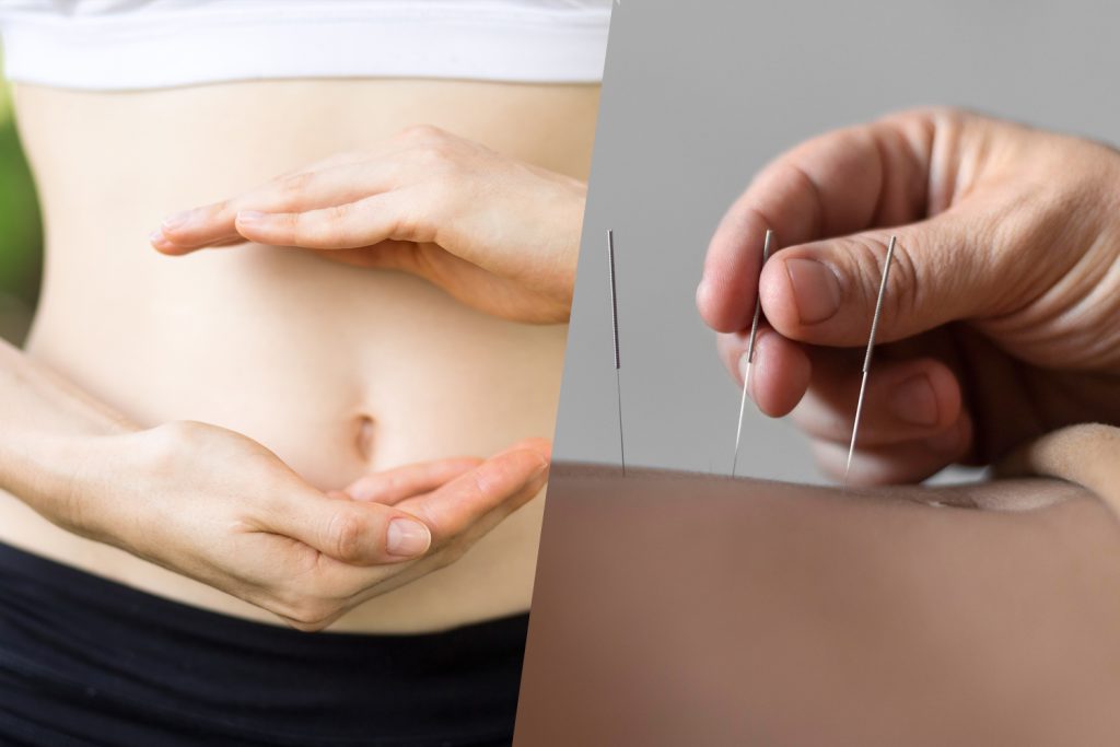 Acupuncture for Weight Loss 1 Acupuncture for Weight Loss