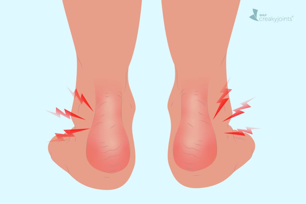 Ankle Pain and Acupuncture Treatment in Tokyo 6 Ankle Pain and Acupuncture Treatment in Tokyo