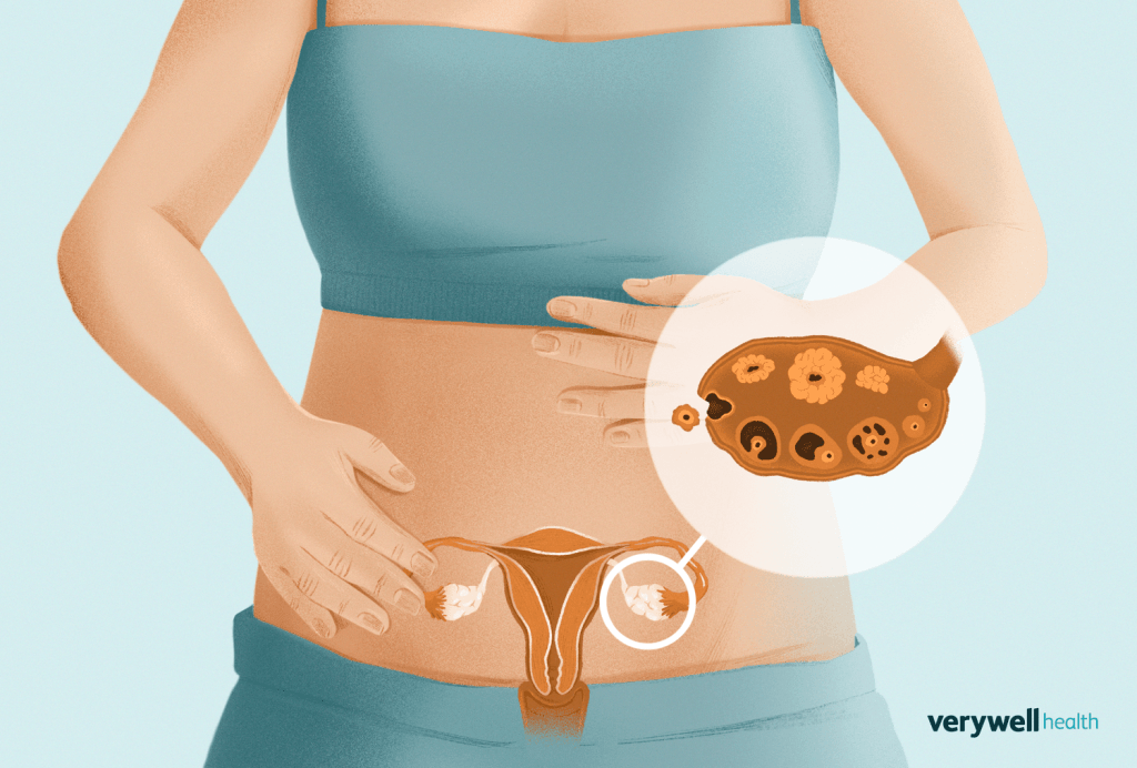 Ovulation pain & Acupuncture treatment in Tokyo