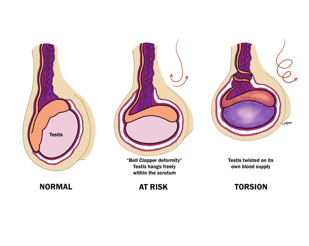 Testicular Pain & Acupuncture Treatment in Tokyo 5 Testicular Pain & Acupuncture Treatment in Tokyo