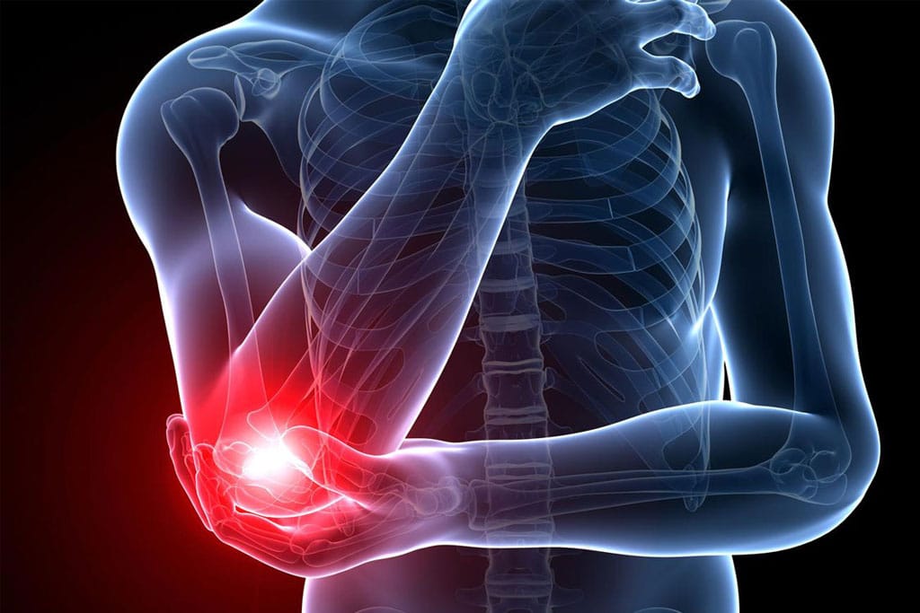 Elbow pain & Acupuncture treatment in Tokyo 6 Elbow pain & Acupuncture treatment in Tokyo