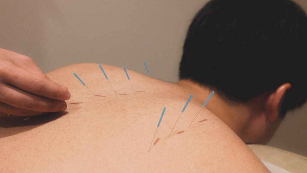 Minato-ku Acupuncture: Your Guide to Holistic Healing in Tokyo