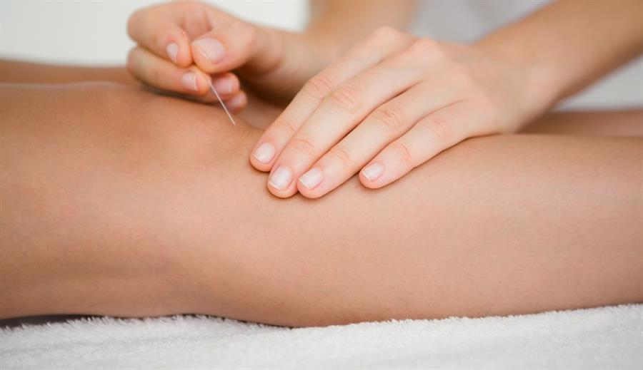 Acupuncture for Knee Pain: A Comprehensive Guide to Natural Relief