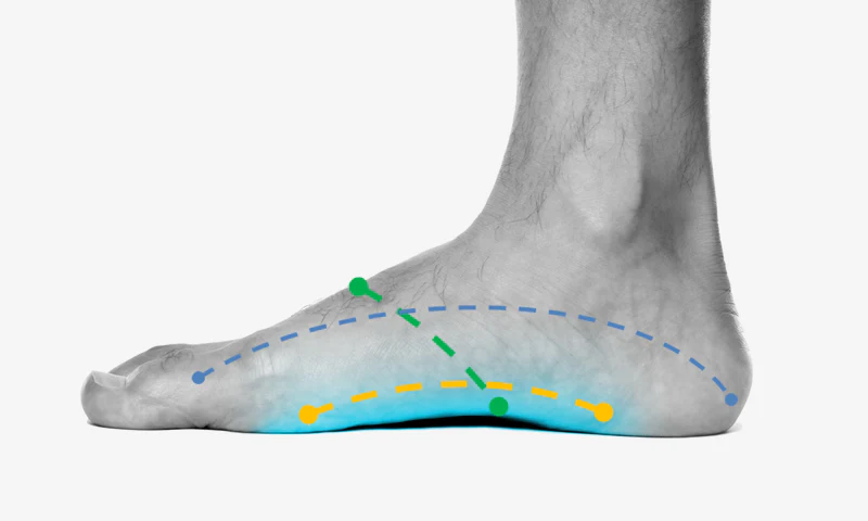 Pain in the Arch of the Foot & Acupuncture Treatment in Tokyo