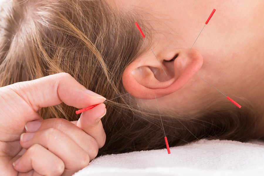 Meniere’s Disease & Acupuncture Treatment in Tokyo