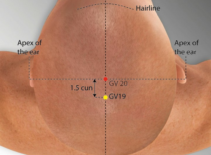 Meniere’s Disease & Acupuncture Treatment in Tokyo