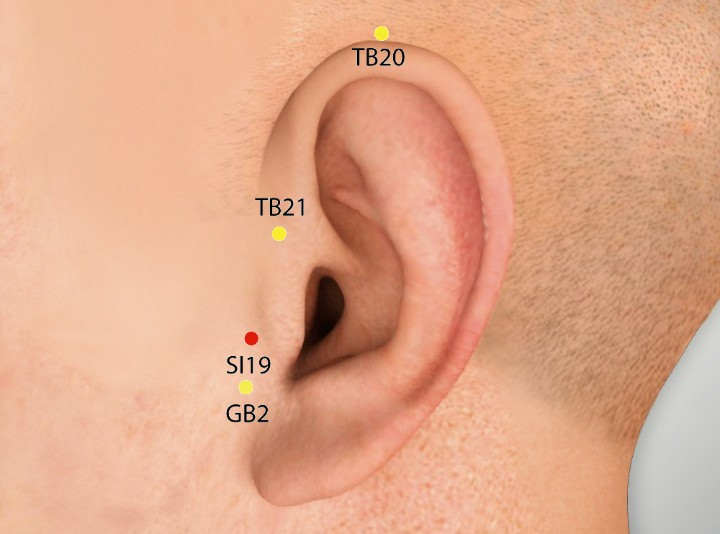 Meniere’s Disease & Acupuncture Treatment in Tokyo