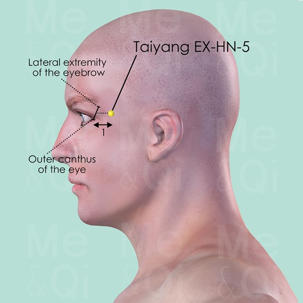 Meniere’s Disease & Acupuncture Treatment in Tokyo