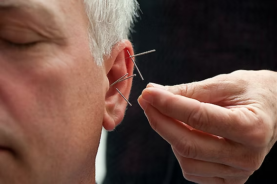 Meniere’s Disease & Acupuncture Treatment in Tokyo