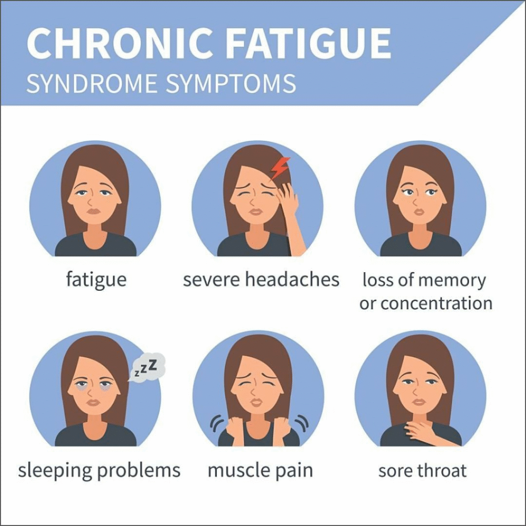 Acupuncture for Chronic Fatigue Syndrome: A Comprehensive Guide