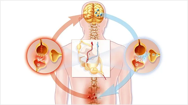 Acupuncture for Chronic Fatigue Syndrome: A Comprehensive Guide