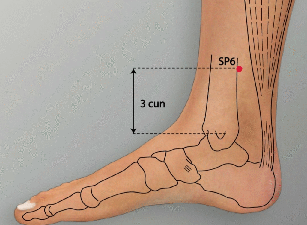 Acupuncture for Chronic Fatigue Syndrome: A Comprehensive Guide