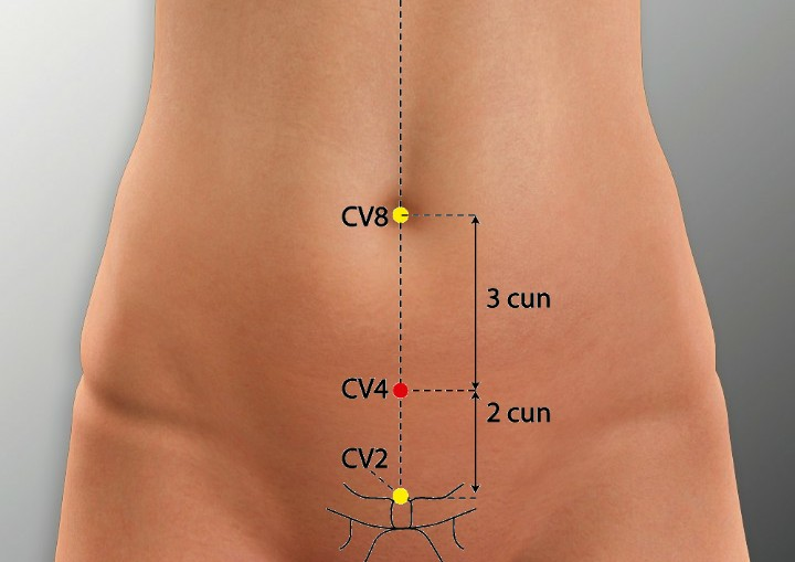 Acupuncture for Chronic Fatigue Syndrome: A Comprehensive Guide