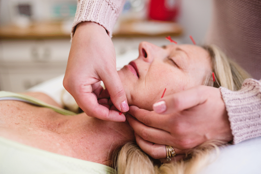 Acupuncture for Trigeminal Neuralgia: A Comprehensive Guide to Pain Relief in Tokyo