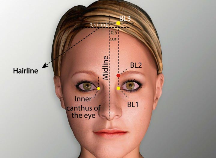 Acupuncture for Trigeminal Neuralgia: A Comprehensive Guide to Pain Relief in Tokyo