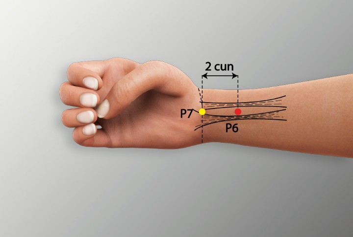Acupuncture for Trigeminal Neuralgia: A Comprehensive Guide to Pain Relief in Tokyo