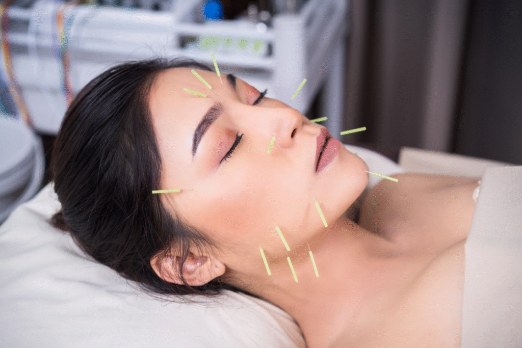 Acupuncture for Trigeminal Neuralgia: A Comprehensive Guide to Pain Relief in Tokyo