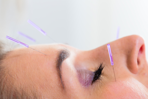 Nasal Congestion and Acupuncture Treatment in Tokyo