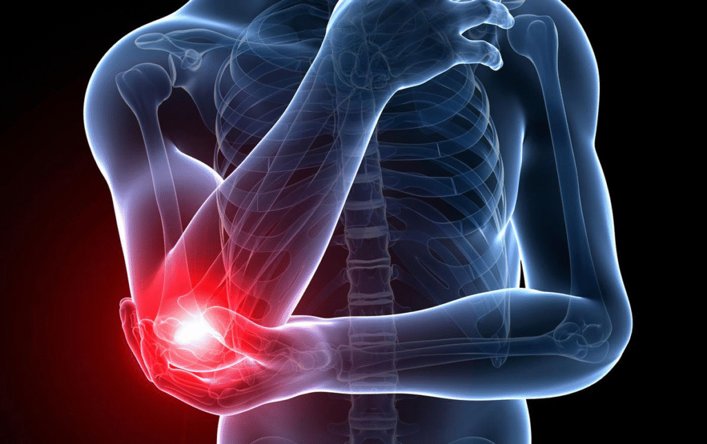 Tennis Elbow and Acupuncture Treatment in Tokyo