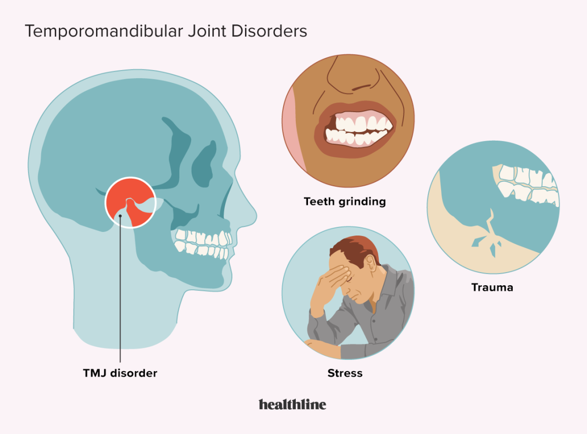 TMJ Disorder and Acupuncture Treatment in Tokyo