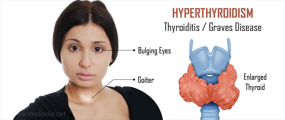 Thyroid Disease and Acupuncture Treatment in Tokyo 2 Thyroid Disease and Acupuncture Treatment in Tokyo