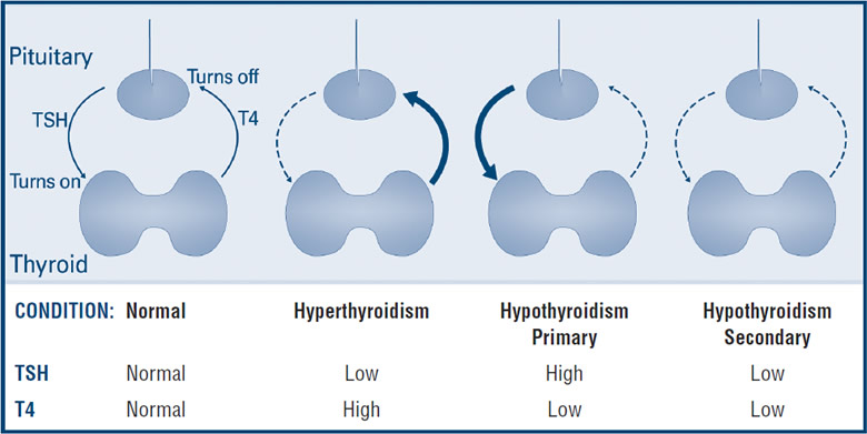 Thyroid Disease and Acupuncture Treatment in Tokyo 4 Thyroid Disease and Acupuncture Treatment in Tokyo